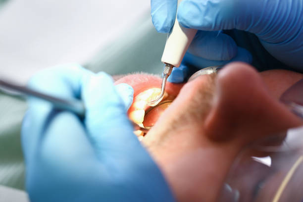 Best Emergency Treatment for Dental Infections or Abscesses in Herricks, NY